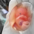 Abortas.jpg